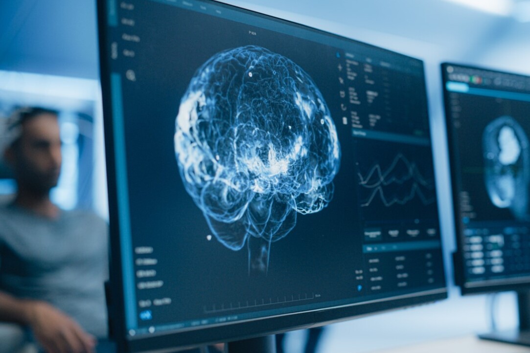 Иллюстрация к новости: «Прямое включение в научный процесс»: в магистратуре НИУ ВШЭ будут готовить нейробиологов